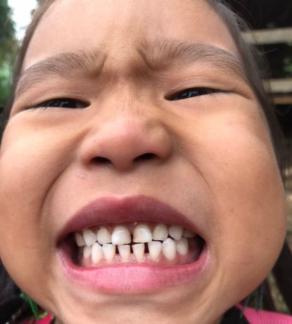 Cuidado Dental